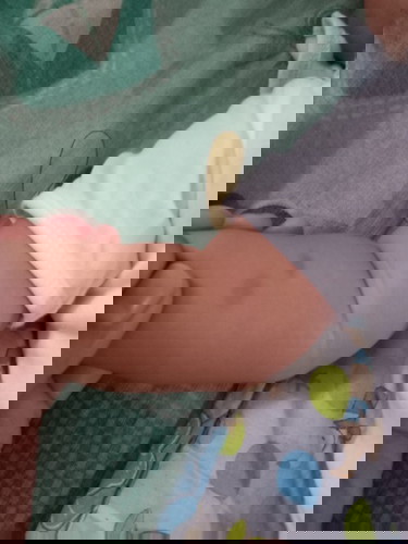 Mosquito bite