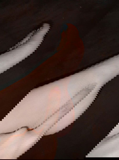 Manas (Edema) Not sure 🤔 HELP, What to do?