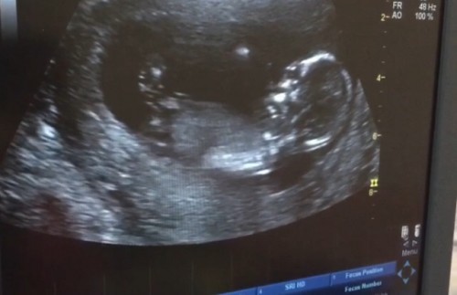 หมอบอกน้องตัวยาวใหญ่