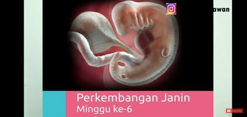 Memakai soflens saat hamil