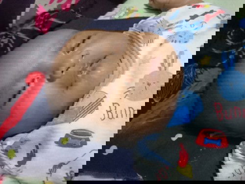 Kena ASI atau Alergi