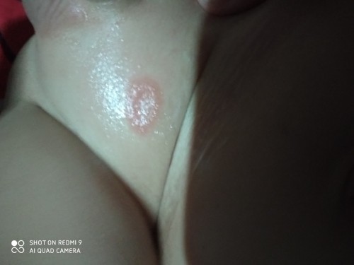 เชื่อราหมาเชื้อราเเมว