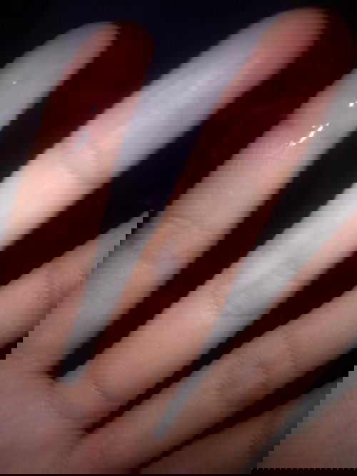 Maaf agak jorok , keluar cairan dari miss v