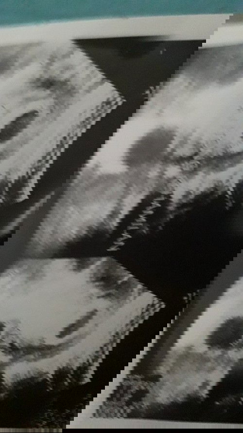 ini hasil usg yang pertama