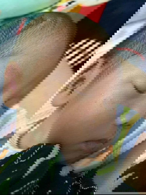 น้องมีผื่นที่แก้มปกติมั้ยคะ