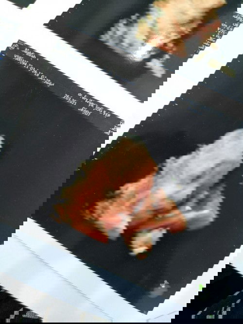 Posisi janin di usia 7 bulan