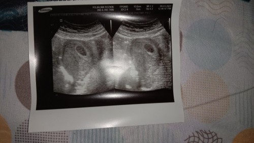 Trimester pertama