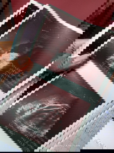 ไปซาวด์ที่โรงบาลมาล่าสุดหมอไม่บอกเพศเลย