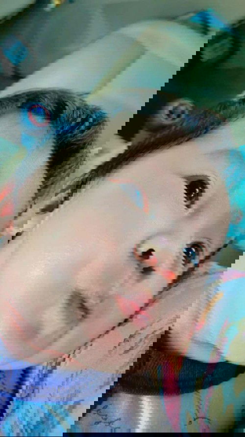 Ruam atau lecet di belakang telinga