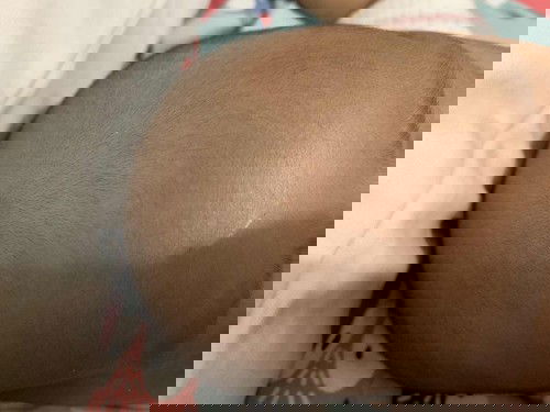 ubun ubun yg tidak terlihat berdenyut