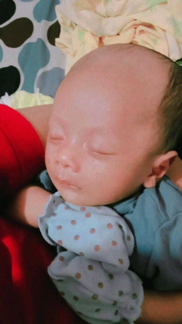 Rambut baby rontok