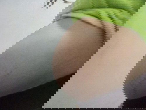 ขอสอบถามแม่ๆหน่อยค่ะพอดีอยากทราบว่าท้องแบบนี้จะได้ลูกชายหรือลูกสาวคะ?
#ท้องแรกค่ะ