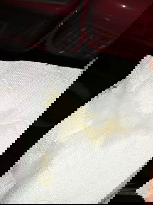 มูกหรือตกขาว