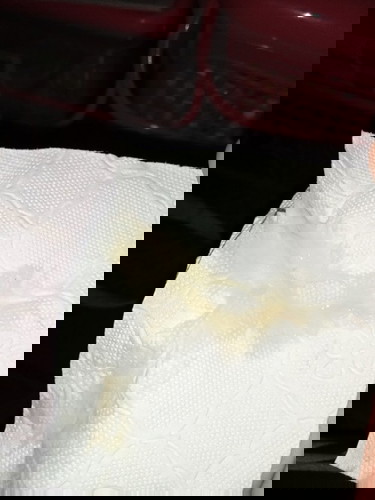 มูกหรือตกขาว