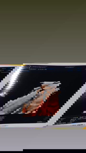 Menantikan kelahiran