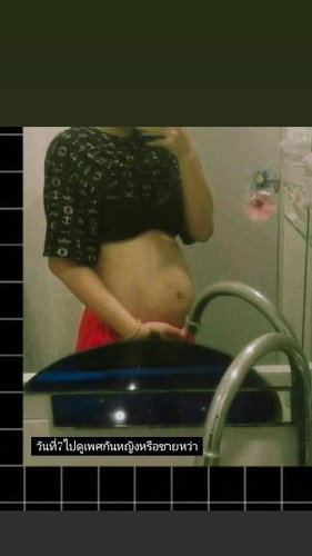 ท้องเเบบนี้