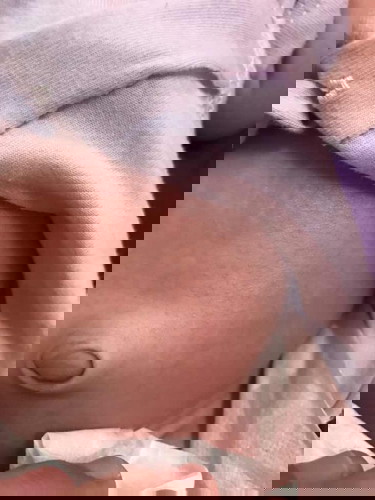 Baby nella sya bru 22 hari . Tumbuh merah2 di badan dan muka. . Mcm mna nak hilngkan?? Saya belum berpengalaman..