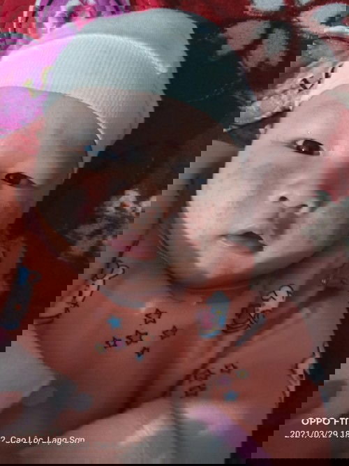 Con e mọc như này thì tắm lá gì cho khỏi ạ cac m