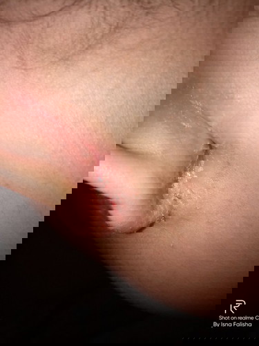 Dari gadis , hamil anak pertama hingga skrg tdk sembuh sembuh