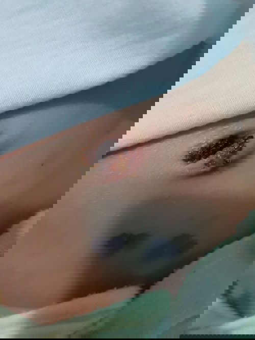 Máy mom ơi sao rốn của con em rụng rồi mà sao nó như dì thì liệu có sao kg ạ