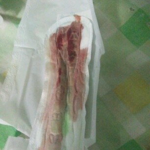 Baka po meron ako same case..
Mag ask na din ako kung anu po ang ginawa nyu..?
Thanks...