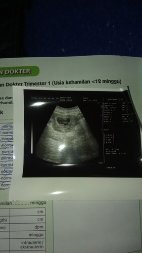 Bun kalo usg di bidan itu sama gk kya usg di dokter? Ini hasil aku usg di bidan hpht 10w tpi usg7w