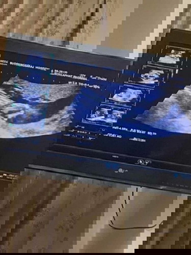 21w3d 👶🏻🤍✌🏻💪🏻