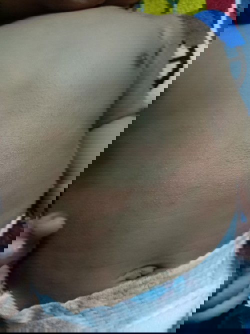 Hi mummy2.. nk tanye kenapa badan ank saye naik ruam2 yew? Mcm mne nk hilang kan? Blh tolong sye x ?