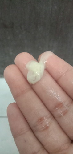 16 weeks na po ako, okay lang po ba na may discharge na ganyan?