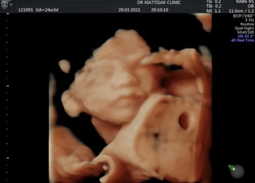 ฉันอุ้มท้องนะ หน้าไม่เหมือนแม่เลย😂