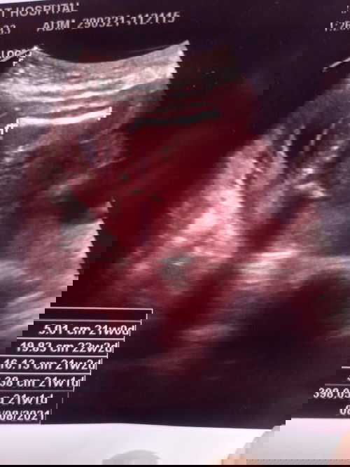 ฝากโรงบาลรัฐหมอไม่บอกอะไรเลย