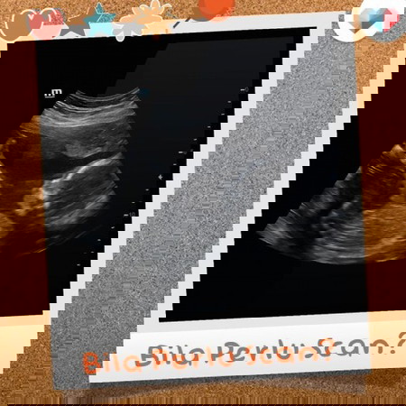 Bila Perlu Scan? Ilmu untuk semua pasangan 🧸