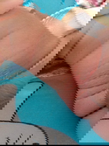 ขออนุญาตสอบถามหน่อยจ้า ลูกเป็นแบบนี้เกิดจากสาเหตุอะไรค่ะ แล้วต้องใช้อะไรถึงจะหาย