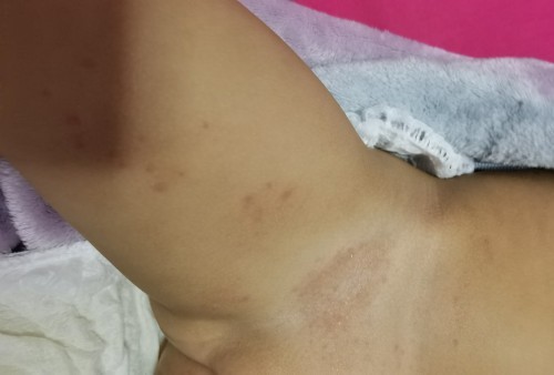 Not sure what is this / allergy / sensitive
