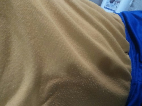 Apakah orang hamil muda selalu mual, dan perut nyesek ke atas? Dan apa sulosinya?
Soalnya saya juga