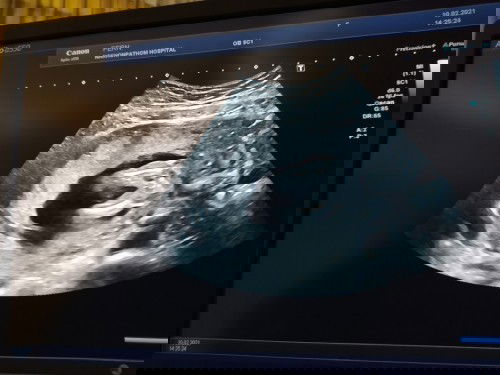 ญ หรือ ช คะ