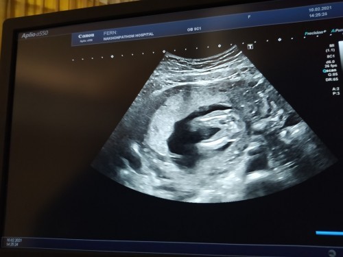 ญ หรือ ช คะ