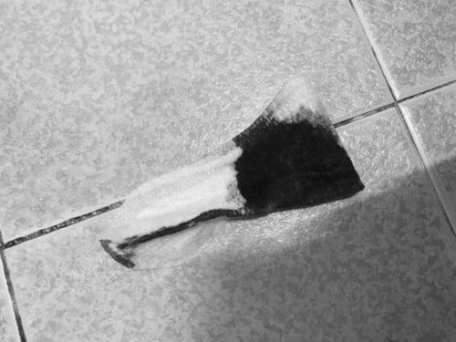 เลือดออกตอน 20w