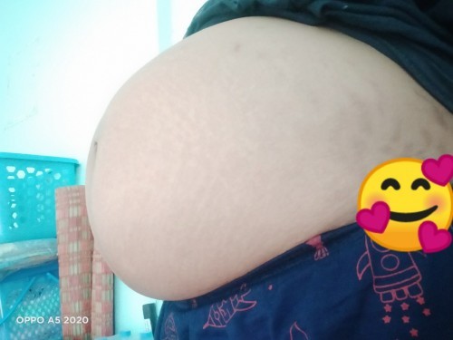 ท้องแบบนี้แม่ๆทั้งหลายคิดว่าเป็นผู้ชายหรือหญิงค่ะ😊