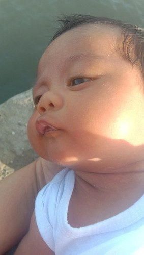 Ano po dapat gawin ko 1mnth and 9 days n baby ko pero madilaw p dn mata nya?