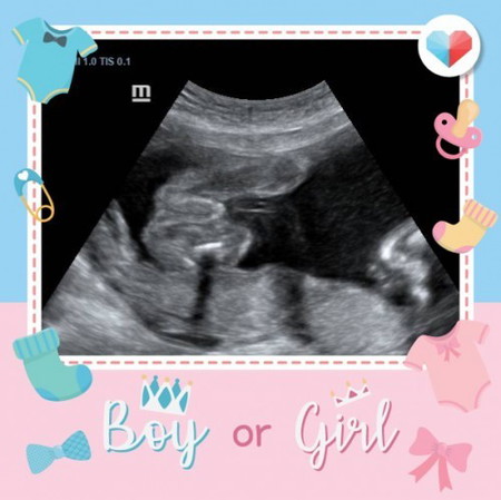 Scan gender