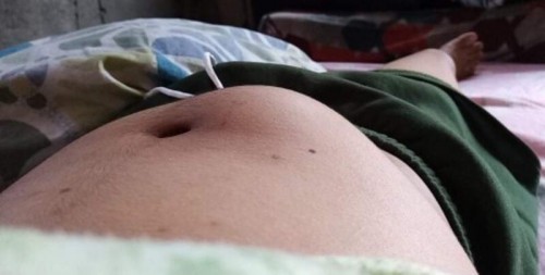 19 weeks pregnant.