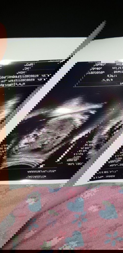 Ass Mom aku mau tnya ini hasil usg aku blan kmren,ini gmbar muka atw bkn yah?