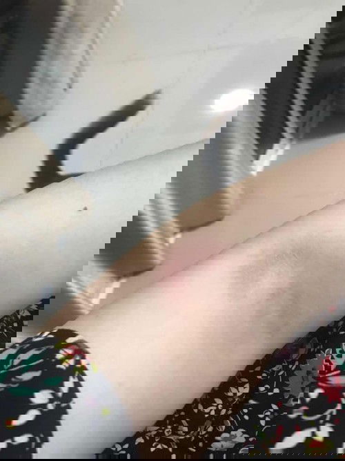 แม่ๆเคยเป็นแบบนี้มั้ยคะ