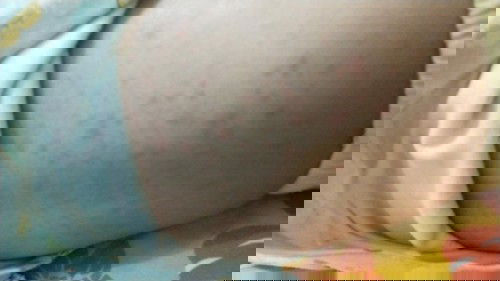 Bintik merah dipunggung