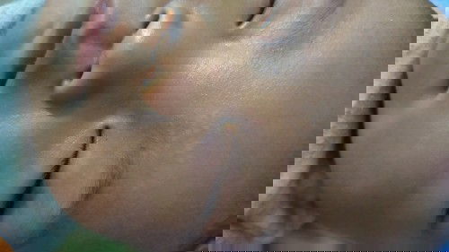 Bercak putih  di muka bayi