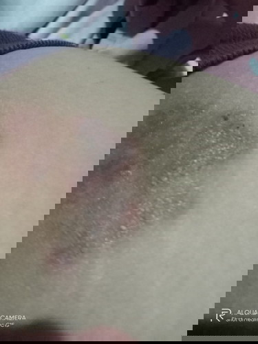 1st Time mom po ako Sino po naranas nito ? Pagkapanganak ko lang at nagtake ako ng pills lumabas na