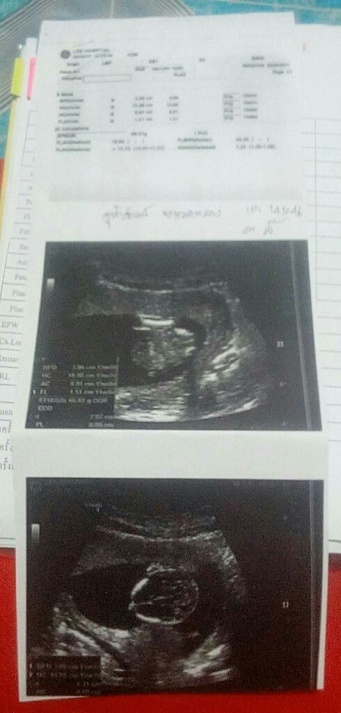 น้องยุตรงไหนหรอค่ะ
#ขอบคุนสำหรับคำตอบค่ะ