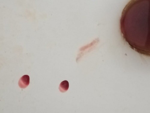 แบบนี้อันตรายไหมค่ะ