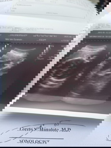 Boy or Girl ??